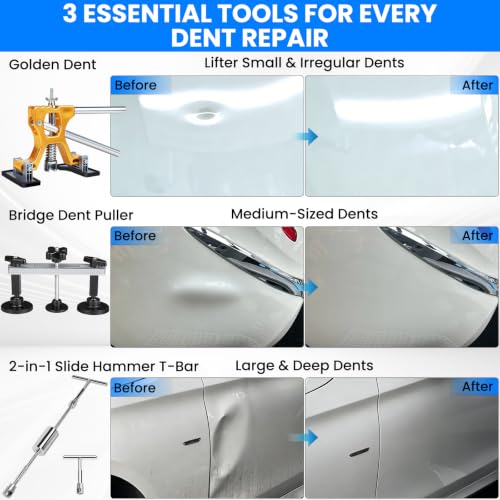 190PCS Car Dent Puller Kit, Paintless Dent Remover Tool for Car Dents