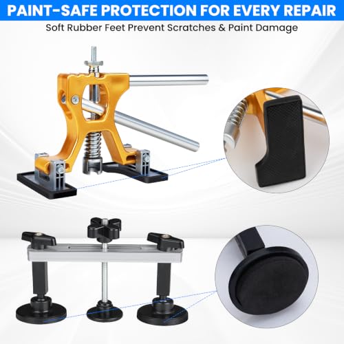 190PCS Car Dent Puller Kit, Paintless Dent Remover Tool for Car Dents