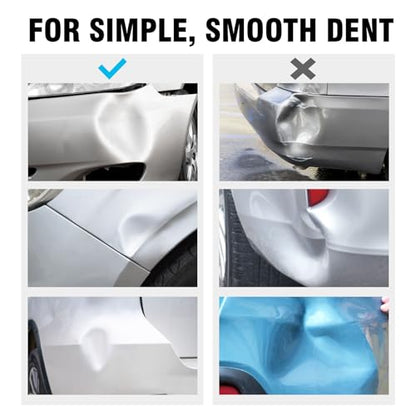 WHDZ Paintless Dent Repair Kit Slide Hammer with 4 Pieces Lockable Aluminum Puller Tab Auto Body Dent Removal Tool