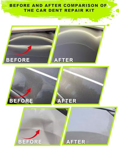 22pcs Car Dent Puller Kit,Paintless Dent Repair Kit - color: 22pcs