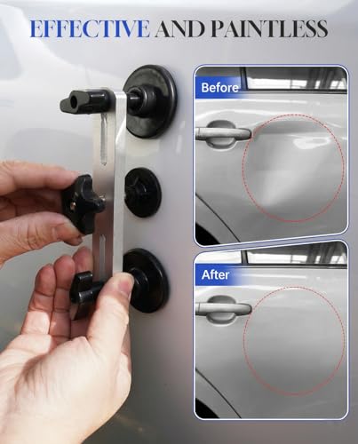 Car Dent Puller Kit, Paintless Dent Remover Tool for Car, Professional Easy-Operate Dent Repair Kit for Hail Damage & Dings, Dent Removal Kit for Auto Body, Truck, Motorcycle