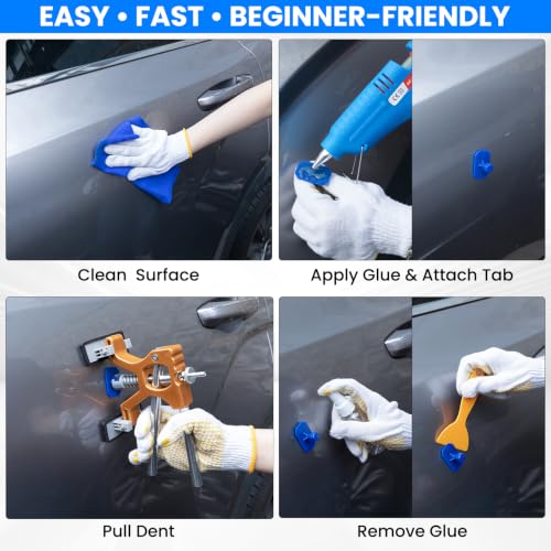 190PCS Car Dent Puller Kit, Paintless Dent Remover Tool for Car Dents