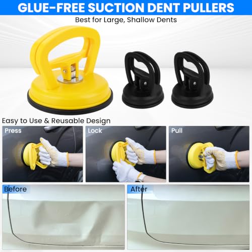 190PCS Car Dent Puller Kit, Paintless Dent Remover Tool for Car Dents