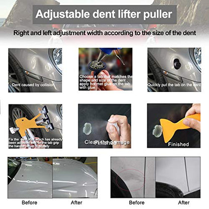 GLISTON Auto Dent Puller Kit - Adjustable Golden Dent Remover Tools Paintless Dent Repair Kit Dent Lifter Puller for Car Small Dent/Ding Hail Dent Removal