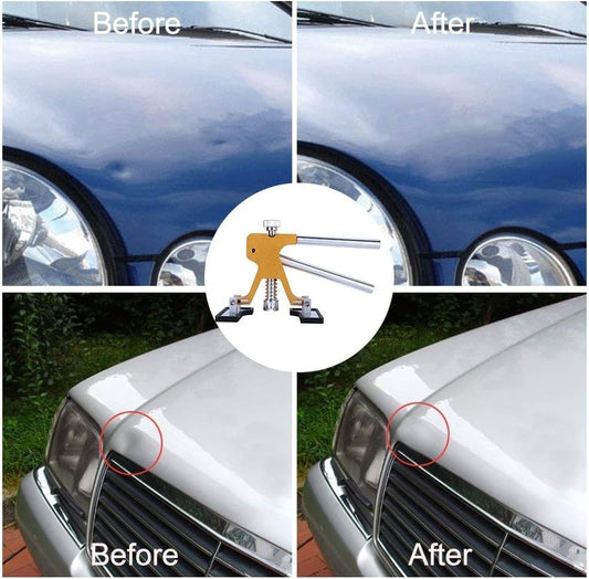 GLISTON Auto Dent Puller Kit - Adjustable Golden Dent Remover Tools Paintless Dent Repair Kit Dent Lifter Puller for Car Small Dent/Ding Hail Dent Removal