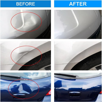 Manelord 25PCS Dent Puller - Car Dent Repair Kit, Dent Removal Kit with Double Pole Bridge Dent Puller for Auto Dent Removal, Door Dings and Car Hail Damage